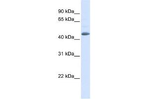 Image no. 1 for anti-Sorting Nexin 5 (SNX5) (N-Term) antibody (ABIN634321)