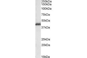 Image no. 1 for anti-Platelet-Activating Factor Acetylhydrolase 1b, Regulatory Subunit 1 (45kDa) (PAFAH1B1) (C-Term) antibody (ABIN184751)