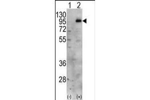 PIP5K1C Antikörper  (C-Term)