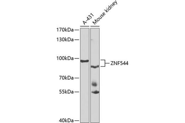 ZNF544 抗体  (AA 1-230)