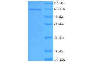 Image no. 1 for serine/threonine Kinase 11 (STK11) (AA 1-429), (partial) protein (His-SUMO Tag) (ABIN5711343)