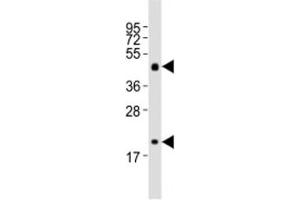 Image no. 3 for anti-Sonic Hedgehog (SHH) (N-Term) antibody (ABIN3032696)
