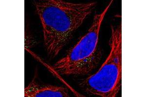 Image no. 1 for anti-CAP-GLY Domain Containing Linker Protein Family, Member 4 (CLIP4) antibody (ABIN5575603)