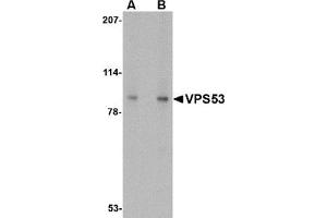 Image no. 2 for anti-Vacuolar Protein Sorting 53 Homolog (VPS53) (C-Term) antibody (ABIN783564)