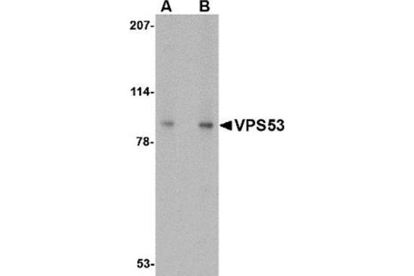 VPS53 antibody  (C-Term)