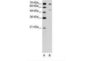 Image no. 1 for anti-Forkhead Box B2 (FOXB2) (AA 51-100) antibody (ABIN6736646)