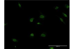 Immunofluorescence of monoclonal antibody to POLR2F on HeLa cell.
