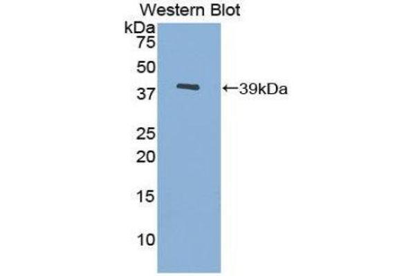 anti-Metallothionein 3 (MT3) (AA 1-68) antibody
