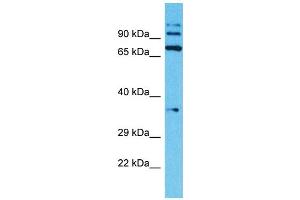 Image no. 1 for anti-Transmembrane Protease, Serine 7 (TMPRSS7) (N-Term) antibody (ABIN2791956)