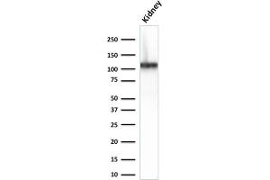 Image no. 1 for anti-Cadherin-16 (CDH16) (AA 371-507) antibody (ABIN6939022)