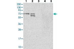 Image no. 1 for anti-BRCA1 Associated Protein (BRAP) antibody (ABIN5649423)