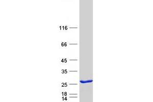 Image no. 1 for V-Ral Simian Leukemia Viral Oncogene Homolog B (Ras Related, GTP Binding Protein) (Ralb) protein (Myc-DYKDDDDK Tag) (ABIN2730432)