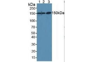Image no. 2 for Carcinoembryonic Antigen Gene Family (CEA) ELISA Kit (ABIN6730922)