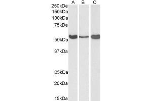 Image no. 4 for anti-Aldehyde Dehydrogenase 1 Family, Member A1 (ALDH1A1) (C-Term) antibody (ABIN184581)