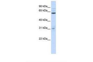 anti-Intestine-Specific Homeobox (ISX) (AA 36-85) antibody