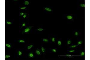 Image no. 4 for anti-Oligodendrocyte Lineage Transcription Factor 2 (OLIG2) (AA 2-78) antibody (ABIN523613)