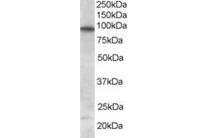 Image no. 2 for anti-Forkhead Box O3 (FOXO3) (C-Term) antibody (ABIN185248)