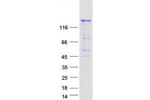 Image no. 1 for Phosphatidylinositol-4-Phosphate 3-Kinase, Catalytic Subunit Type 2 beta (PIK3C2B) protein (Myc-DYKDDDDK Tag) (ABIN2728944)