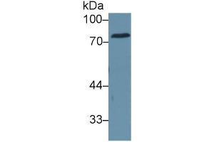 Image no. 3 for Carcinoembryonic Antigen Gene Family (CEA) ELISA Kit (ABIN6730886)