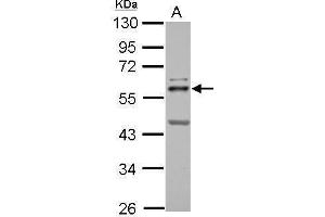 Image no. 2 for anti-V-Ets Erythroblastosis Virus E26 Oncogene Homolog 2 (ETS2) (Center) antibody (ABIN2855845)