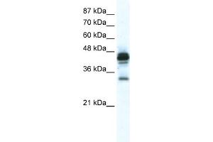 Image no. 1 for anti-Gap Junction Protein, epsilon 1 (GJE1) (C-Term) antibody (ABIN2774877)
