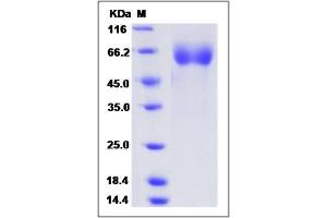 Image no. 1 for Interleukin 12 alpha (IL12A) (AA 1-219) protein (Fc Tag) (ABIN2010104)