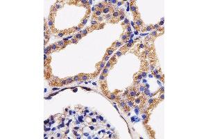 Image no. 2 for anti-Adenylate Kinase 4 (AK4) (AA 119-153) antibody (ABIN1944856)
