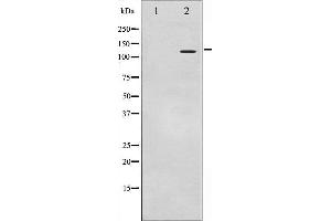 Image no. 2 for anti-Histone Deacetylase 9 (HDAC9) antibody (ABIN6269422)