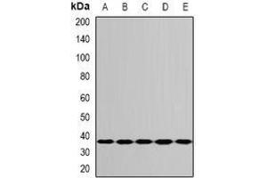 Image no. 2 for anti-Ribosomal Protein S3A (RPS3A) (full length) antibody (ABIN6006054)