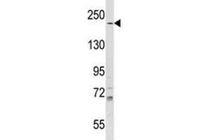 IQGAP1 antibody western blot analysis in T47D lysate.