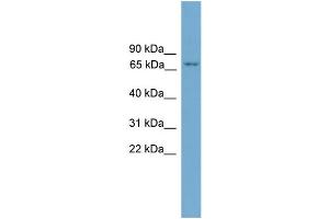 Image no. 1 for anti-Protein Kinase C, eta (PRKCH) (N-Term) antibody (ABIN2786852)