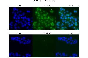 Image no. 3 for anti-Protein Phosphatase 1, Regulatory (Inhibitor) Subunit 10 (PPP1R10) (N-Term) antibody (ABIN2778807)
