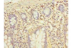 Immunohistochemistry of paraffin-embedded human small intestine tissue using ABIN7143395 at dilution of 1:100