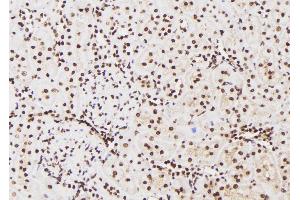 Image no. 2 for anti-Janus Kinase 1 (JAK1) (pTyr1125) antibody (ABIN6269943)