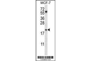 Image no. 1 for anti-PYD and CARD Domain Containing (PYCARD) (AA 129-158), (C-Term) antibody (ABIN657783)
