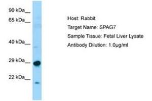 Image no. 1 for anti-Sperm Associated Antigen 7 (SPAG7) (N-Term) antibody (ABIN6750073)