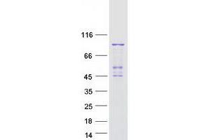 Image no. 1 for Phospholipase A2, Group VI (Cytosolic, Calcium-Independent) (PLA2G6) (Transcript Variant 1) protein (Myc-DYKDDDDK Tag) (ABIN2729083)