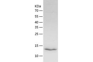 TMEM27 Protein (AA 15-141) (His tag)