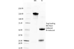 Image no. 5 for anti-Tumor-Associated Calcium Signal Transducer 2 (TACSTD2) (AA 31-274) antibody (ABIN6939971)