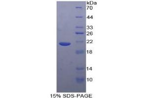 Image no. 2 for Tumor Necrosis Factor alpha (TNF alpha) ELISA Kit (ABIN6574142)