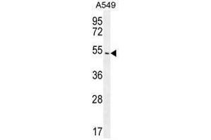 Image no. 2 for anti-Arrestin, beta 1 (ARRB1) (AA 343-371), (C-Term) antibody (ABIN950521)