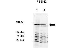 Image no. 2 for anti-Presenilin 2 (Alzheimer Disease 4) (PSEN2) (N-Term) antibody (ABIN2781802)