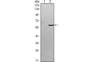 Image no. 3 for anti-B Lymphoid Tyrosine Kinase (BLK) antibody (ABIN968983)