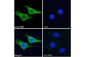 Image no. 2 for anti-Connective Tissue Growth Factor (CTGF) (AA 111-123) antibody (ABIN6391343)