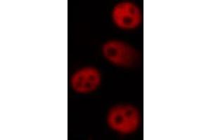 Image no. 2 for anti-Mitogen-Activated Protein Kinase-Activated Protein Kinase 5 (MAPKAPK5) (pThr182) antibody (ABIN6255616)