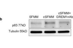 Image no. 7 for anti-T-Complex 1 (TCP1) (Internal Region) antibody (ABIN2855394)