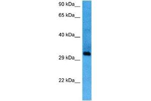Image no. 2 for anti-SIX Homeobox 1 (SIX1) (Middle Region) antibody (ABIN2779599)