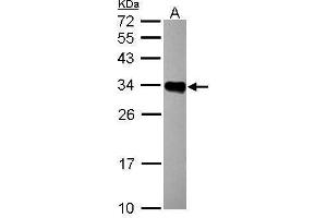 Image no. 2 for anti-Major Histocompatibility Complex, Class II, DR beta 1 (HLA-DRB1) (Center) antibody (ABIN2855994)