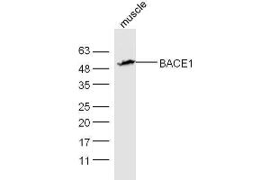 Mouse muscle lysates probed with Rabbit Anti-BACE1 Polyclonal Antibody, Unconjugated  at 1:5000 for 90 min at 37˚C.