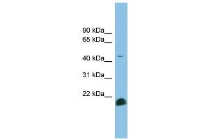 Image no. 2 for anti-Transforming Growth Factor, beta 2 (TGFB2) (Middle Region) antibody (ABIN2782223)